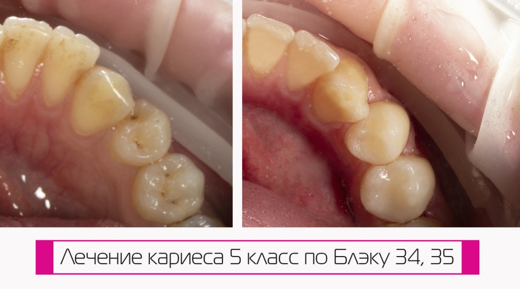 Посмотреть работы стоматологов на Тургенева. Запись онлайн в Краснодаре (ФМР)
