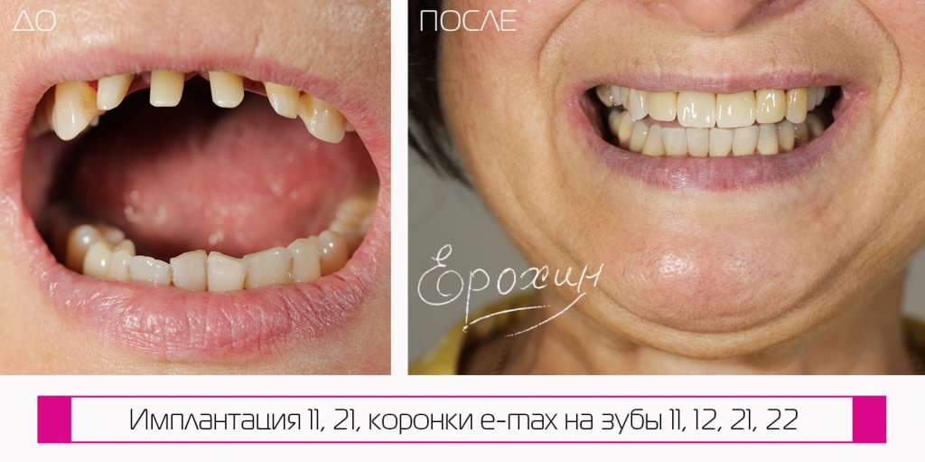Фото до и после. Запись онлайн на безоплатную консультацию в Краснодаре