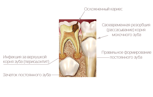 Формирование зубов у детей